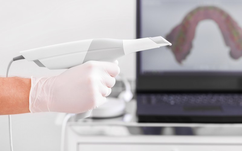 TRIOS 3D Scanner, Parksville Dentist